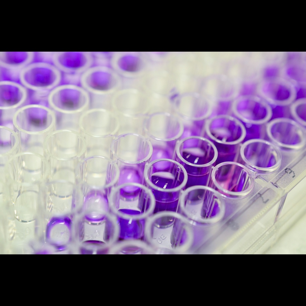 Human Ferritin Heavy Chain, FTH1 ELISA Ki, 96 tests